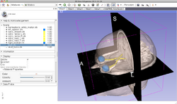 Slicer4Minute tutorial