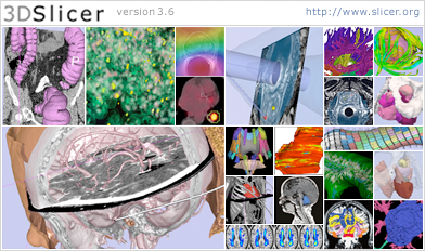 Slicer 3.6 released in June 2010