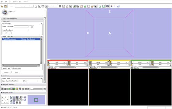 Modules:NeuroNav-Documentation-3.6 - Slicer Wiki