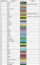 Announcements:Slicer3.6 - Slicer Wiki