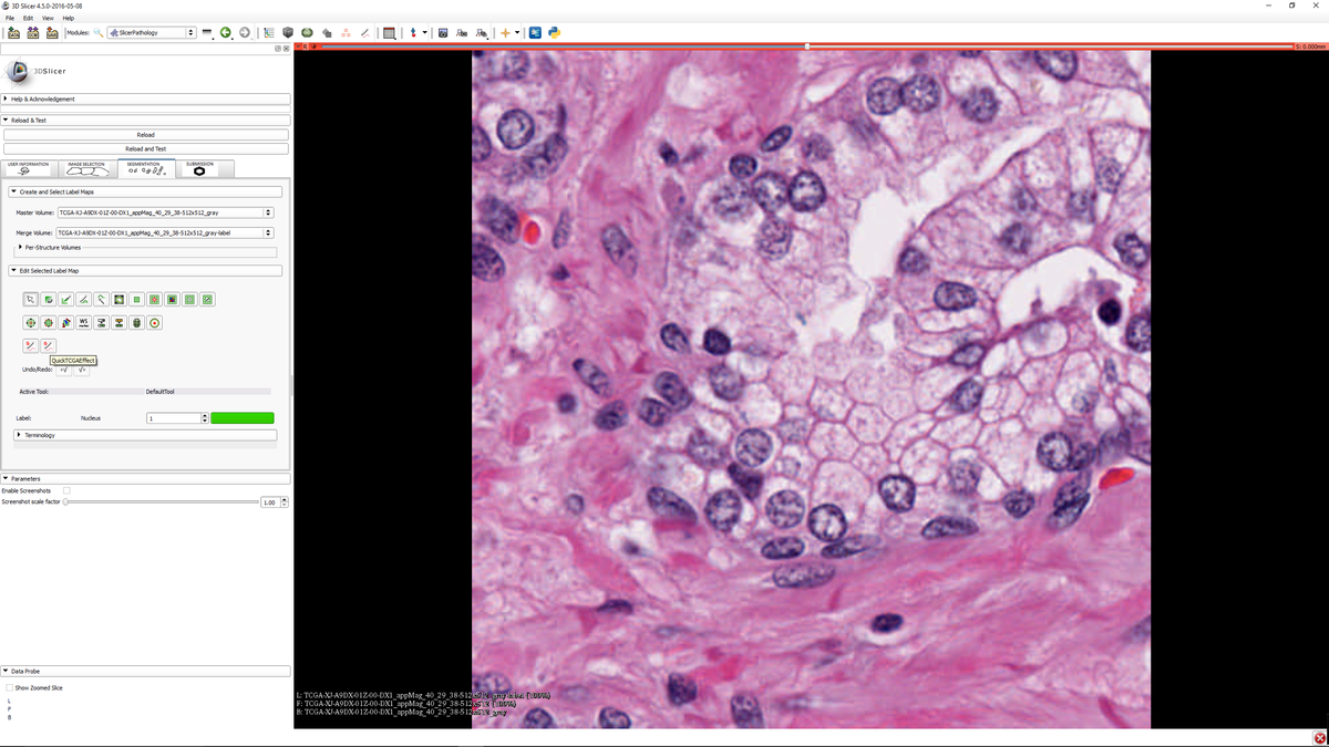 Documentation Nightly Extensions Slicerpathology Slicer Wiki