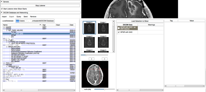 Documentation Nightly Slicerapplication Loadingdata Slicer Wiki