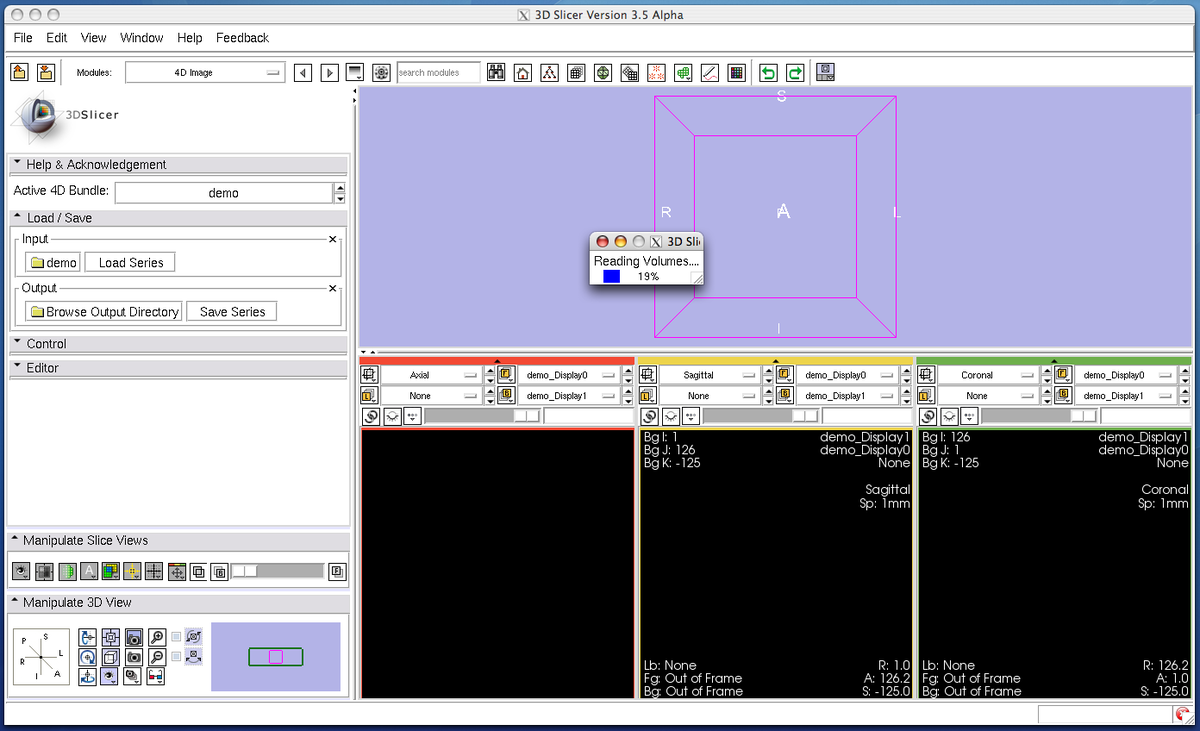 Modules:FourDImage-Documentation-3.6 - Slicer Wiki