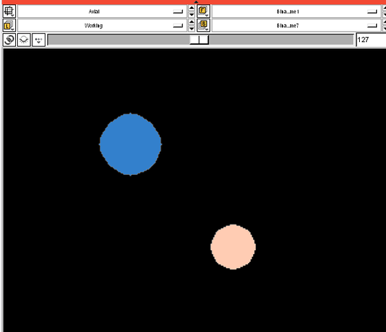 Slicer3:Module:BinaryErodeOperations-Documentation-3.2 - Slicer Wiki