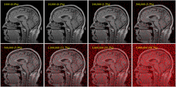 sample point densities on one slice of a brain MRI with 256x256x130 voxels; useful coverage requires at least 5% coverage for affine, more as DOF increase