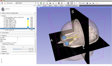 Documentation\/4.10\/Training - Slicer Wiki