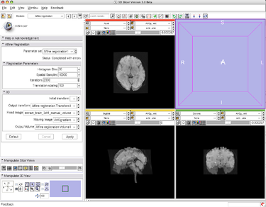 Slicer3:LinearRegistrationUseCases - Slicer Wiki